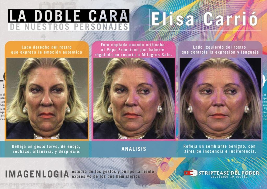 Imagenologia-Carrio-Bien