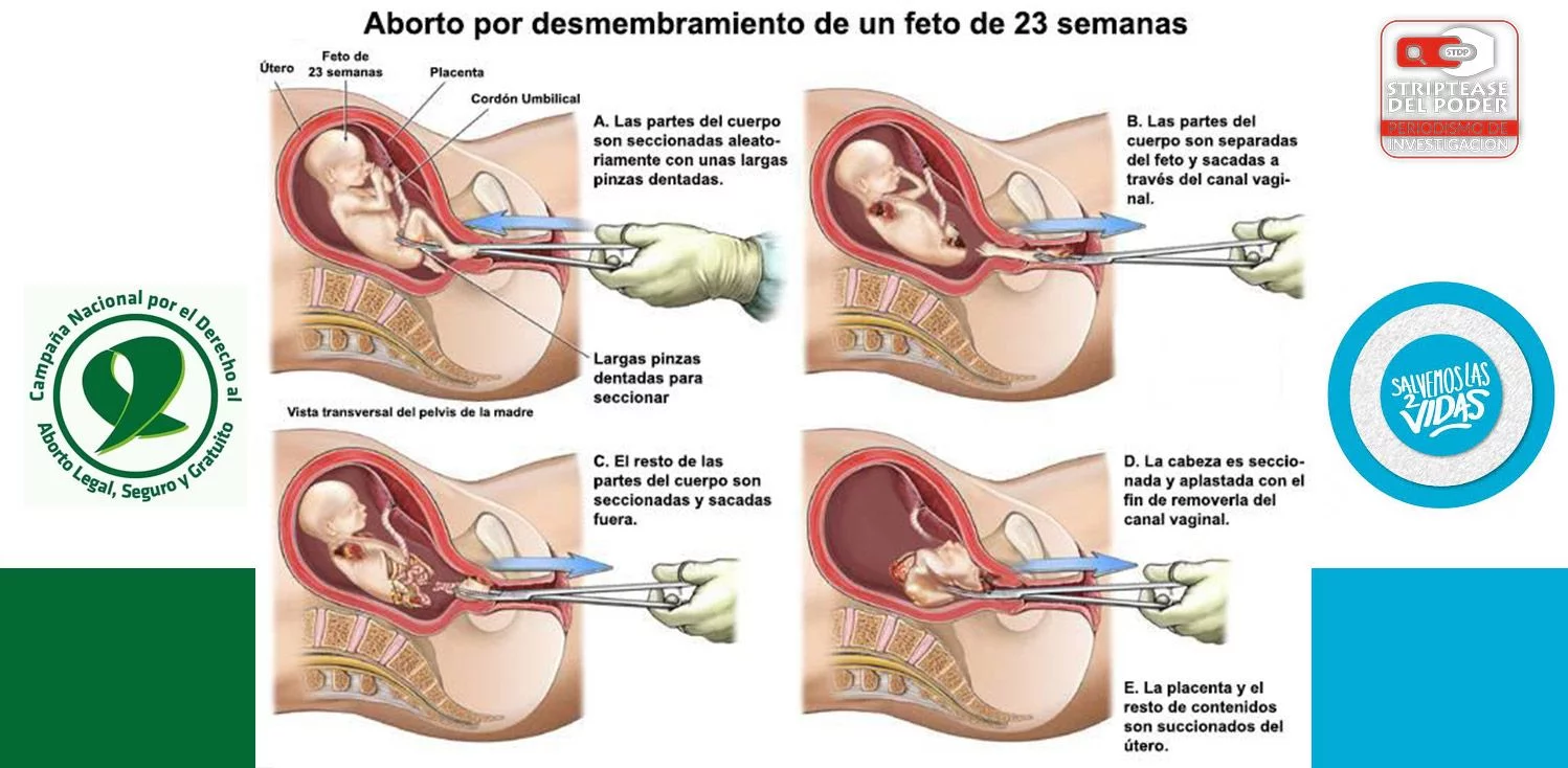 Aborto, presidente de EEUU Gerald Ford, FMI, Christine Lagarde, Informe Rockefeller, Feministas, John Rockefeller III, Seguridad Nacional Henry Kissinger, Brent Scowcroft, y Gerald Ford