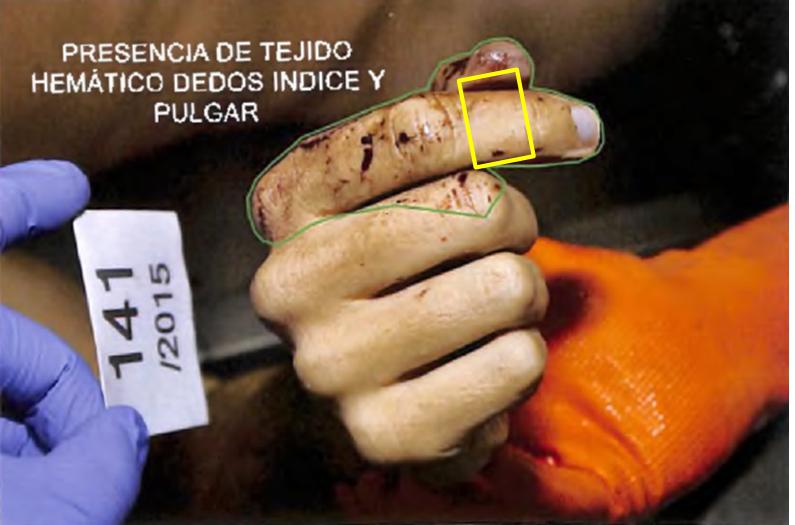 Alberto Nisman, Antonio Stiuso, Alberto Mazzino, Fernando Pocino, AFI , suicidio, Diego Lagomarsino, perito informático, AMIA, Alberto Nisman, Gendarmería, pericia, Cuerpo Médico Forense, Policía Federal Lanata, Héctor Gambini, Lucia Salinas, Maria Eugenia Duffart , Clarin, Lagomarsino, Stiuso, Cristina Fernandez de Kirchner, Iran, EEUU, Medios de Comunicación